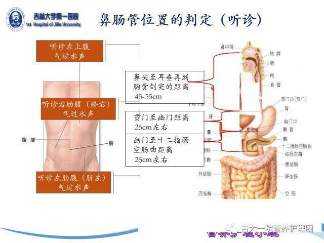 前沿护理技术解析：全新鼻肠管照护策略PPT教程